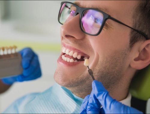 ISOIMPLANT Certification: How to Ensure Your Dentist is Approved