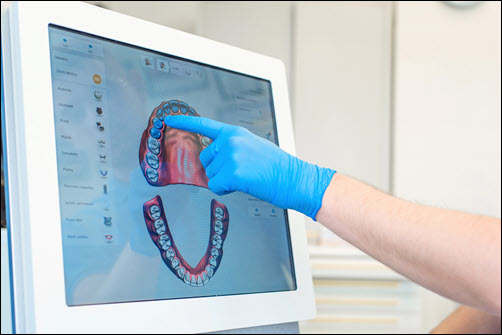 3D Oral Scan